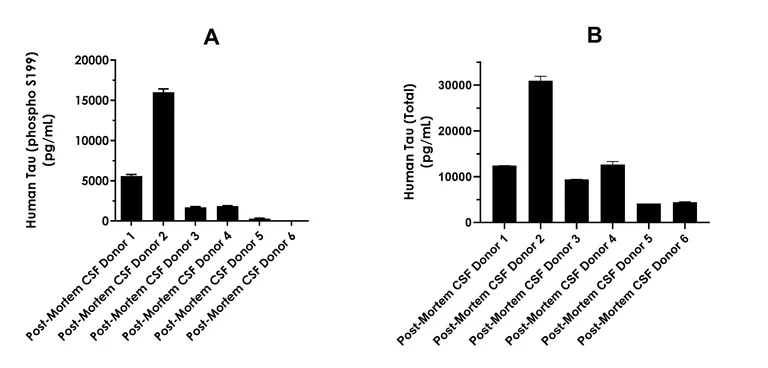 Sandwich ELISA - Human Tau (phospho S199) ELISA Kit, Chemiluminescent - Extracellular (AB325893)