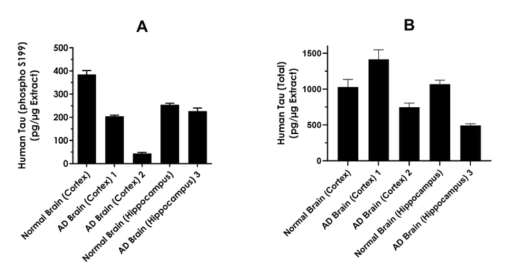 Sandwich ELISA - Human Tau (phospho S199) ELISA Kit- Intracellular (AB323735)
