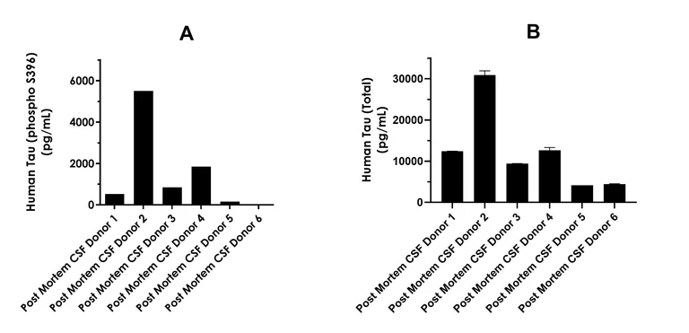 Sandwich ELISA - Human Tau (phospho S396) ELISA Kit- Extracellular (AB324328)