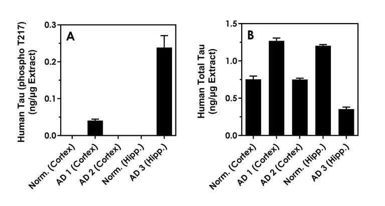 Sandwich ELISA - Human Tau (phospho T217) ELISA Kit - Intracellular (AB318935)