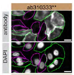Immunocytochemistry/ Immunofluorescence - Human TGM2 (Transglutaminase 2) knockout A549 cell line (AB261876), expandable thumbnail