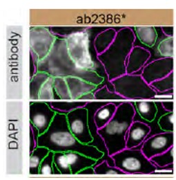 Immunocytochemistry/ Immunofluorescence - Human TGM2 (Transglutaminase 2) knockout A549 cell line (ab261876), expandable thumbnail