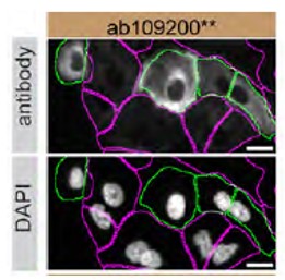Immunocytochemistry/ Immunofluorescence - Human TGM2 (Transglutaminase 2) knockout A549 cell line (ab261876), expandable thumbnail