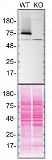Western blot - Human TGM2 (Transglutaminase 2) knockout A549 cell line (AB261876), expandable thumbnail