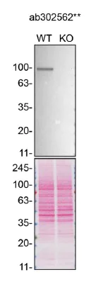 Western blot - Human TICAM1 knockout U-87MG cell line (AB305279)
