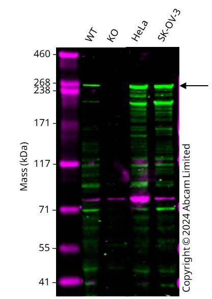 Western blot - Human TLN1 knockout PC-3 cell line (AB290495), expandable thumbnail