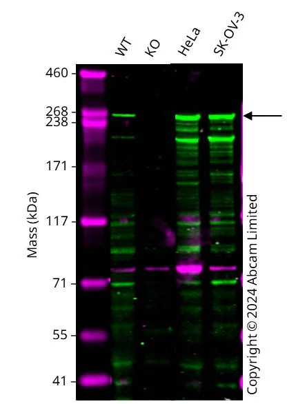 Western blot - Human TLN1 knockout PC-3 cell line (AB290495)