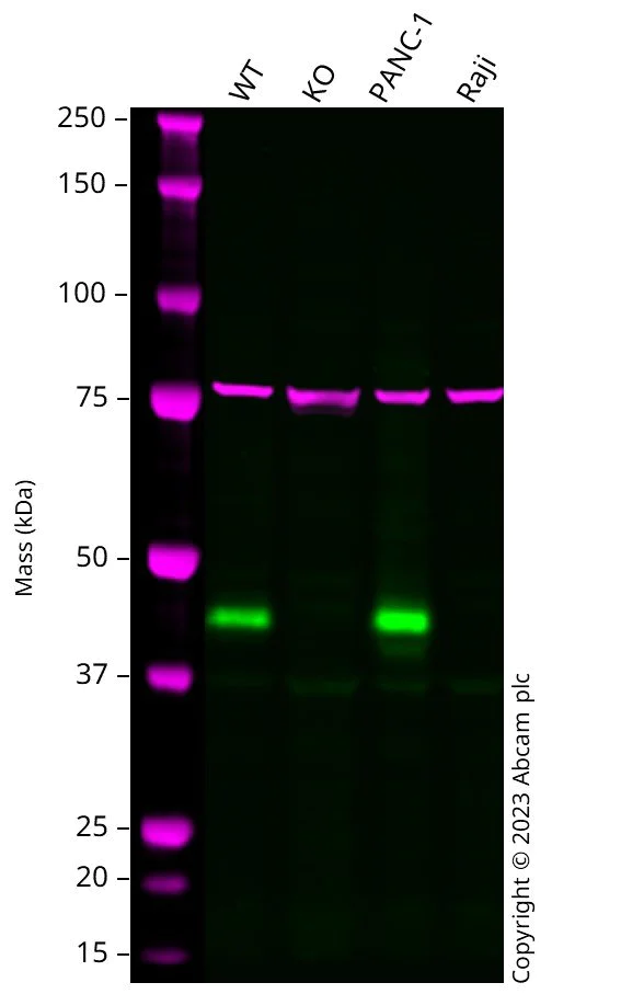 Western blot - Human TMEM106B knockout A549 cell lysate (AB273769)
