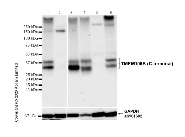Western blot - Human TMEM106B knockout A549 cell lysate (AB273769)