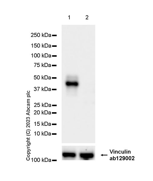 Western blot - Human TNFRSF10A (DR4) knockout HeLa cell lysate (AB258726)