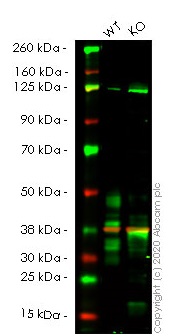 Human TNFRSF10B (DR5) knockout HeLa cell lysate