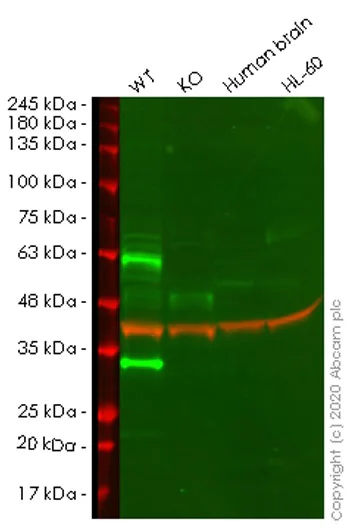 Western blot - Human TNFRSF1A (TNF Receptor I) knockout HeLa cell line (AB265972)