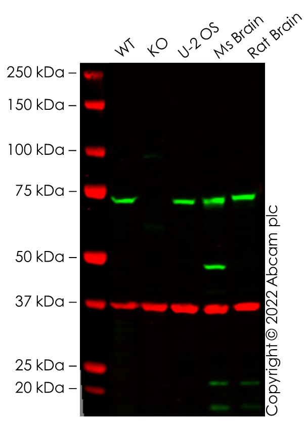 Western blot - Human TOMM70A (TOM70) knockout HeLa cell line (AB265396), expandable thumbnail
