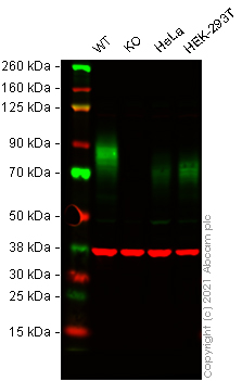 Western blot - Human TPBG knockout MCF7 cell lysate (AB269661), expandable thumbnail