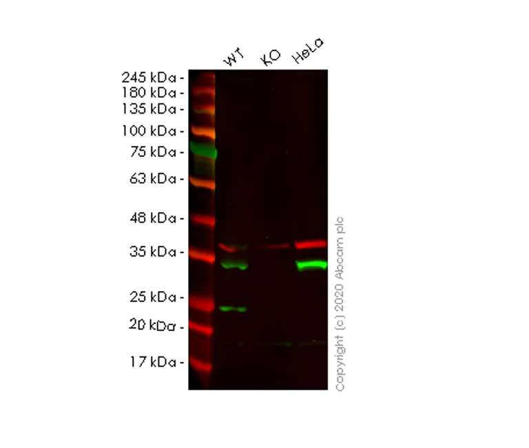 Western blot - Human TPM4 knockout HEK-293T cell lysate (AB257758)