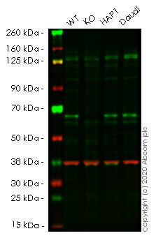 Western blot - Human TRAF6 knockout HeLa cell line (AB266009), expandable thumbnail