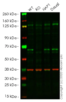 Western blot - Human TRAF6 knockout HeLa cell lysate (AB257760)