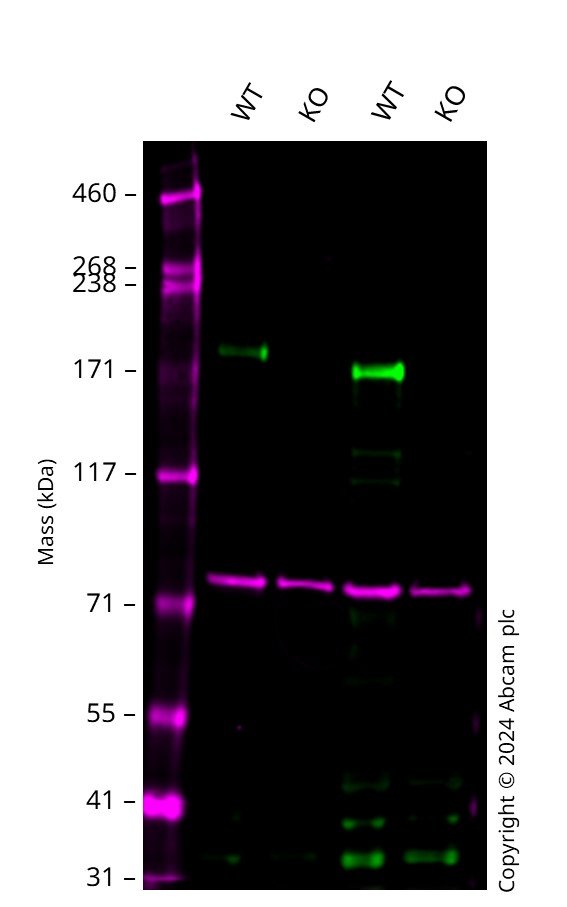 Western blot - Human TSC2 (Tuberin) knockout A549 cell line (AB277867), expandable thumbnail