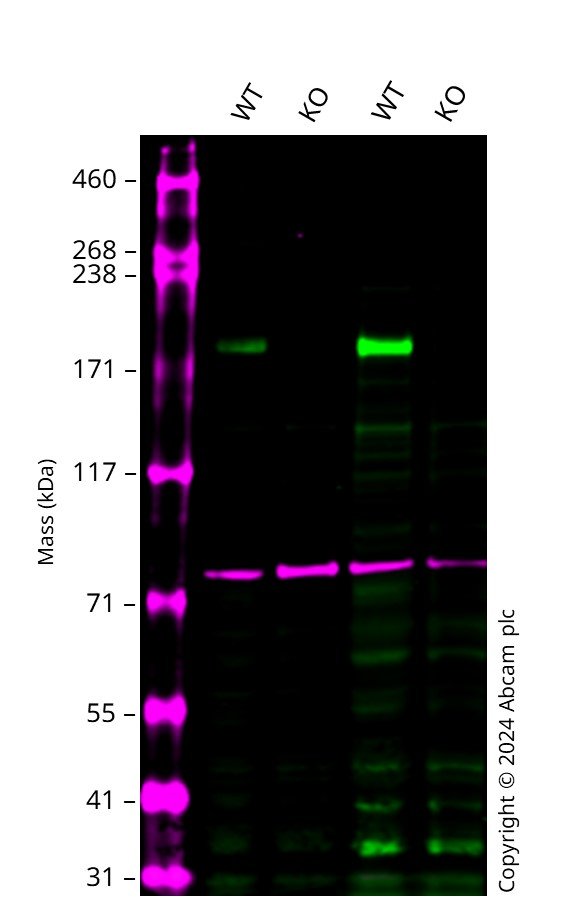 Western blot - Human TSC2 (Tuberin) knockout A549 cell line (AB277867), expandable thumbnail