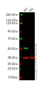 Western blot - Human TUBB3 (beta III Tubulin) knockout HeLa cell lysate (AB263857)