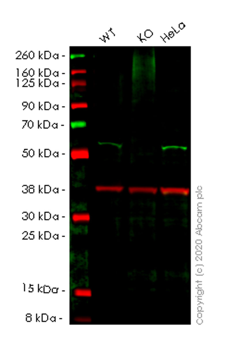 Western blot - Human UBXN6 (UBXD1) knockout HEK-293T cell lysate (AB258747), expandable thumbnail