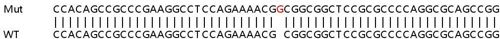Human UHMK1 (KIST/KIS) knockout HeLa cell lysate