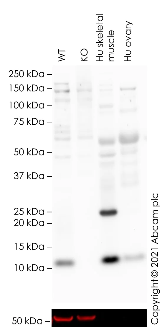Western blot - Human UQCRQ knockout HEK-293T cell line (AB267244)