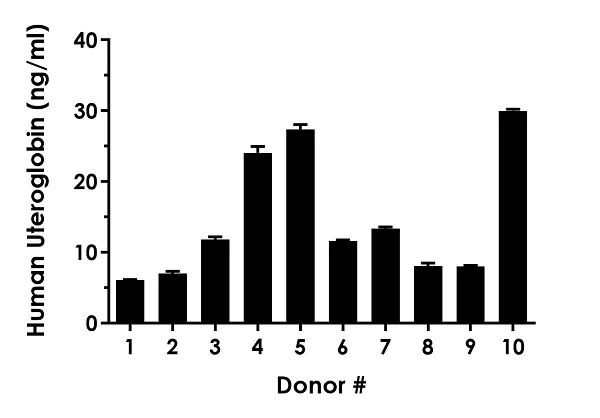 Sandwich ELISA - Human Uteroglobin ELISA Kit (AB238266)