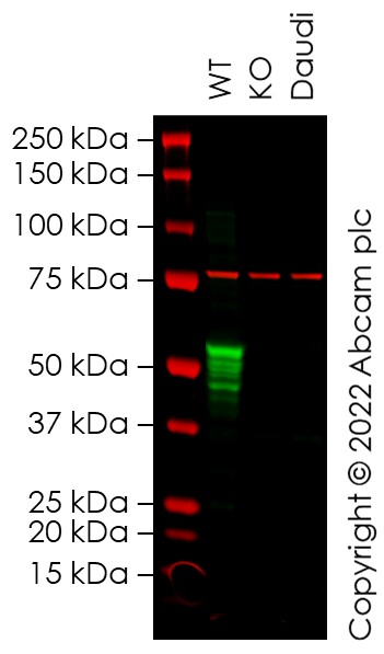 Western blot - Human VIM knockout A549 cell line (AB288984), expandable thumbnail