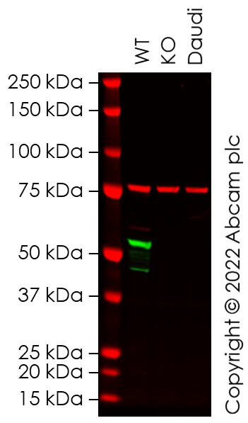 Western blot - Human VIM knockout A549 cell line (AB288984), expandable thumbnail