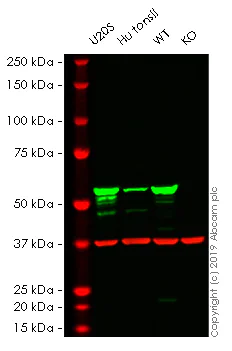 Western blot - Human VIM (Vimentin) knockout HeLa cell lysate (AB263775)