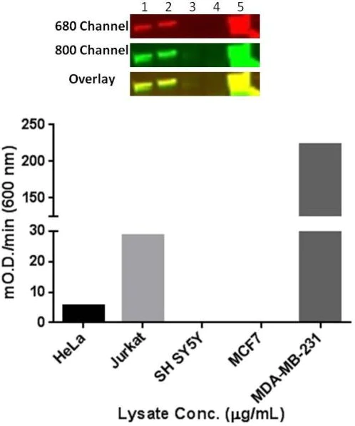 Sandwich ELISA - Human Vimentin Profiling ELISA Kit (AB173190)