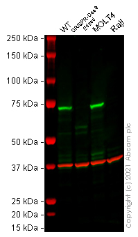 Western blot - Human ZAP70 knockout Jurkat cell line (AB273841)