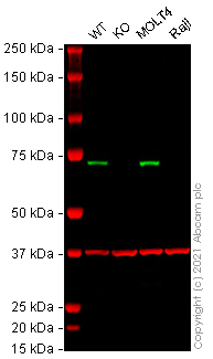 Western blot - Human ZAP70 knockout Jurkat cell lysate (AB273795)
