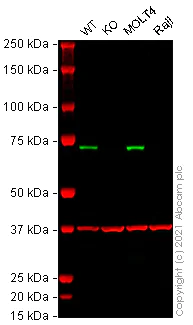 Western blot - Human ZAP70 knockout Jurkat cell lysate (AB273795)