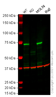 Western blot - Human ZAP70 knockout Jurkat cell lysate (AB273795)