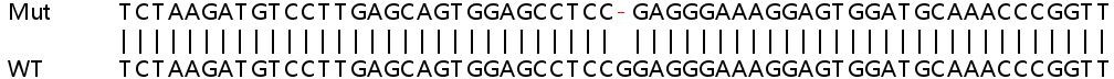 Sanger Sequencing - Human ZNF609 knockout HeLa cell line (AB265076), expandable thumbnail