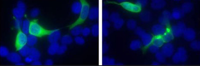 Immunocytochemistry/ Immunofluorescence - Anti-Huntingtin antibody (AB155942)