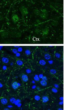 Immunohistochemistry - Anti-Huntingtin antibody (AB155942)
