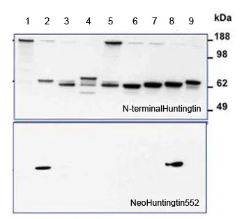 Western blot - Anti-Huntingtin antibody (AB155942)