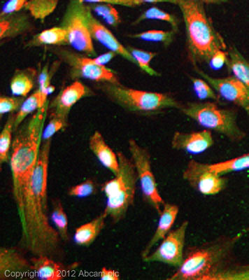 Immunocytochemistry/ Immunofluorescence - Anti-Huntingtin antibody [EP867Y] (AB45169), expandable thumbnail