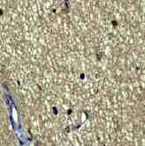 Immunohistochemistry (Formalin/PFA-fixed paraffin-embedded sections) - Anti-Huntingtin antibody [EP867Y] (AB45169), expandable thumbnail