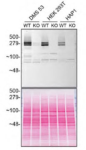 Western blot - Anti-Huntingtin antibody [EP867Y] (ab45169), expandable thumbnail