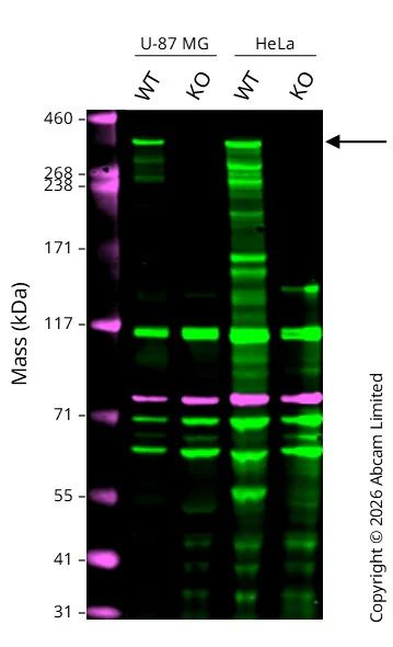 Western blot - Anti-Huntingtin antibody [EP867Y] (AB45169)