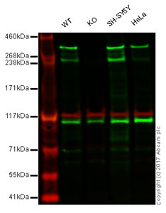 Western blot - Anti-Huntingtin antibody [EP867Y] (AB45169), expandable thumbnail