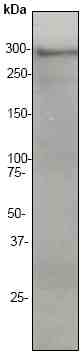 Western blot - Anti-Huntingtin antibody [EP867Y] (ab45169), expandable thumbnail