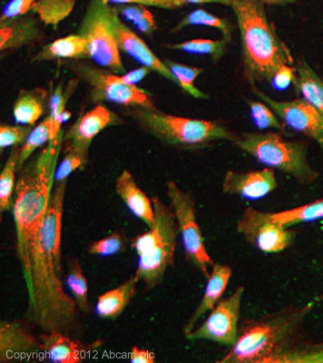 Immunocytochemistry/ Immunofluorescence - Anti-Huntingtin antibody [EP867Y] - BSA and Azide free (AB225573)
