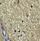 Immunohistochemistry (Formalin/PFA-fixed paraffin-embedded sections) - Anti-Huntingtin antibody [EP867Y] - BSA and Azide free (AB225573)