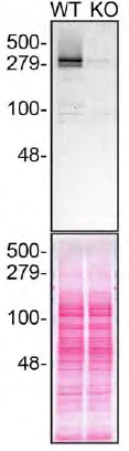 Western blot - Anti-Huntingtin antibody [EP867Y] - BSA and Azide free (AB225573)