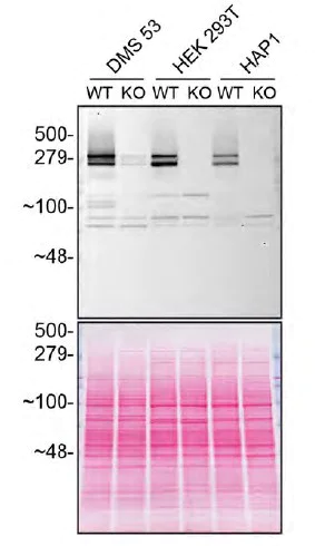 Western blot - Anti-Huntingtin antibody [EP867Y] - BSA and Azide free (AB225573)